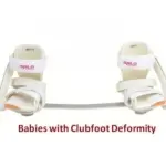 Dennis Brown Splint