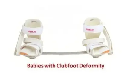 Denis Browne Splint: A Parent's Guide to Clubfoot Correction and Relapse Prevention